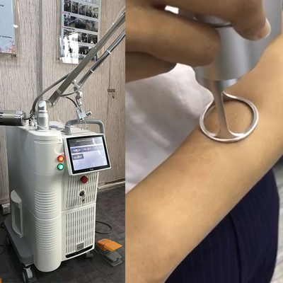 Haut, die Vaginal Rejuvenations-CO2 Bruchlaser-Maschine TEM00 erneuert